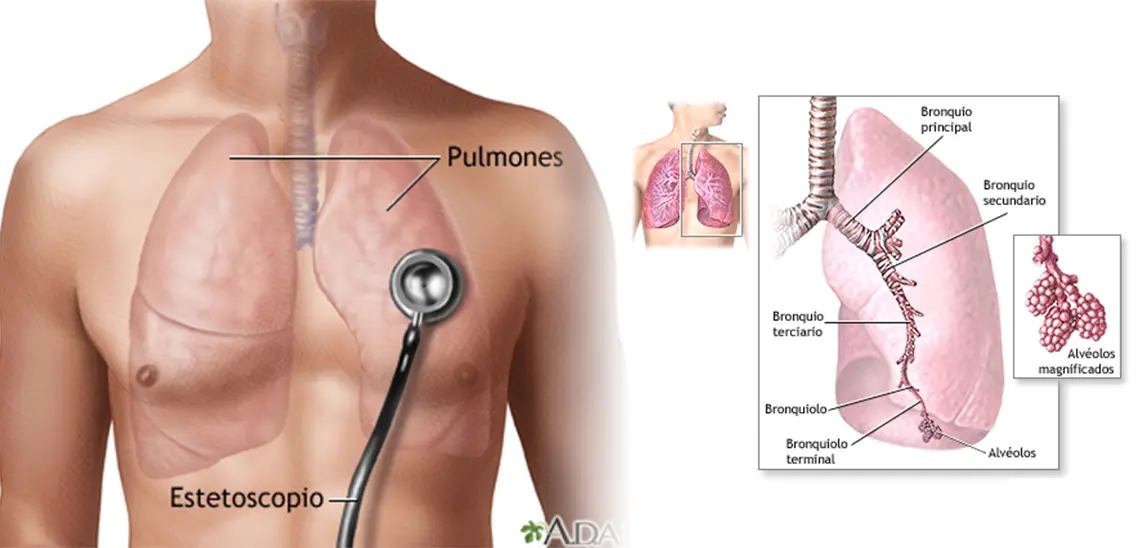 Guía completa sobre el ruido al respirar: causas, diagnóstico y tratamiento - Qué ruidos respiratorios se escuchan en neumonía ruido a respiración rastreador - Qué ruidos respiratorios se escuchan en neumonía